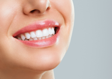 Front Tooth Crowns: Your Quick Guide
