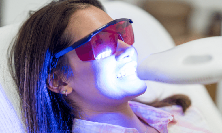 Laser vs Zoom Teeth Whitening