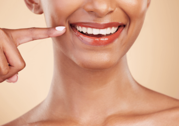 Long-term Effects of Teeth Whitening: Upland Dentist's Insight