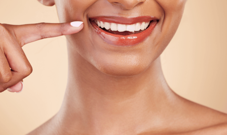 Woman with newly whitened teeth