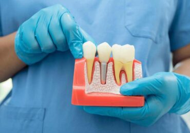 7 Signs of Dental Implant Failure: What To Do When They Occur