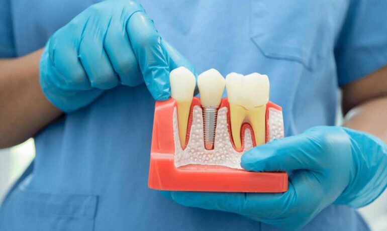 signs of a bad dental implant